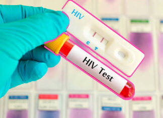 “Hazte la Prueba”: campaña impulsa el diagnóstico oportuno y combate la discriminación