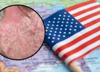 El miedo vence a la ideología: El brote de sarampión en EU pone a los antivacunas en fila