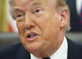 El enigma de las manos con moretones de Donald Trump: informe de la Casa Blanca revela su verdadero estado de salud a días de cumplir 80 años