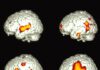 El cerebro bilingüe sorprende: idiomas distintos activan patrones más parecidos de lo esperado
