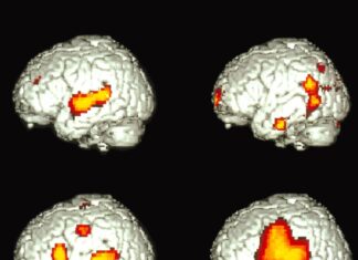 El cerebro bilingüe sorprende: idiomas distintos activan patrones más parecidos de lo esperado