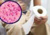 ¿Qué es la ciclosporiasis? La infección vinculada a un brote gastrointestinal en Estados Unidos